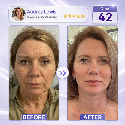 ✨👍𝐆𝐚𝐟𝐚𝐜𝐞® 𝐂𝐨𝐥𝐥𝐚𝐠𝐞𝐧 & 𝐅𝐮𝐥𝐥𝐞𝐫𝐞𝐧𝐞 𝐑𝐨𝐥𝐥𝐞𝐫 𝐅𝐢𝐫𝐦𝐢𝐧𝐠 𝐂𝐫𝐞𝐚𝐦