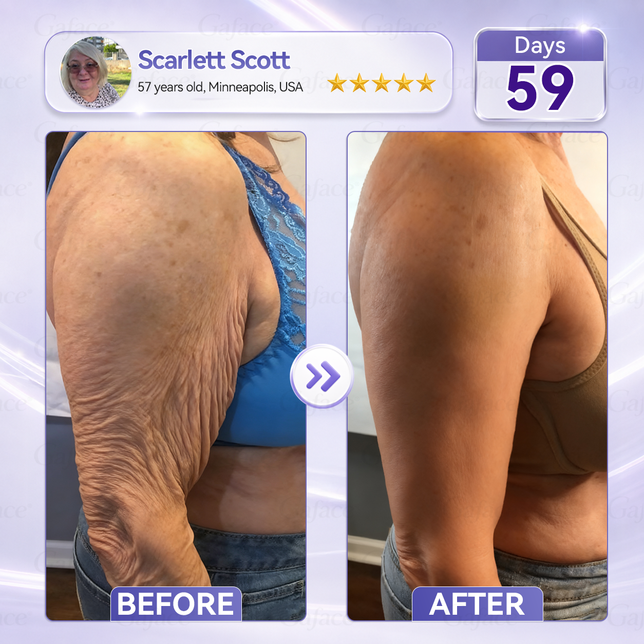 ✨👍𝐆𝐚𝐟𝐚𝐜𝐞® 𝐂𝐨𝐥𝐥𝐚𝐠𝐞𝐧 & 𝐅𝐮𝐥𝐥𝐞𝐫𝐞𝐧𝐞 𝐑𝐨𝐥𝐥𝐞𝐫 𝐅𝐢𝐫𝐦𝐢𝐧𝐠 𝐂𝐫𝐞𝐚𝐦