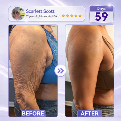 ✨👍𝐆𝐚𝐟𝐚𝐜𝐞® 𝐂𝐨𝐥𝐥𝐚𝐠𝐞𝐧 & 𝐅𝐮𝐥𝐥𝐞𝐫𝐞𝐧𝐞 𝐑𝐨𝐥𝐥𝐞𝐫 𝐅𝐢𝐫𝐦𝐢𝐧𝐠 𝐂𝐫𝐞𝐚𝐦
