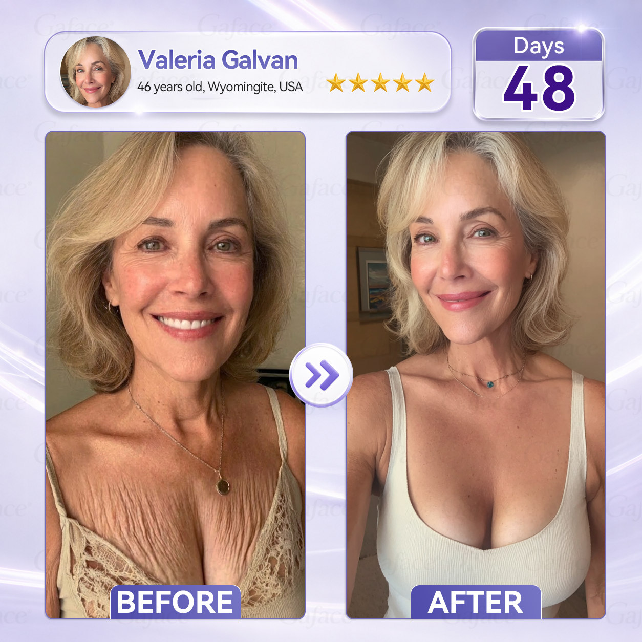 ✨👍𝐆𝐚𝐟𝐚𝐜𝐞® 𝐂𝐨𝐥𝐥𝐚𝐠𝐞𝐧 & 𝐅𝐮𝐥𝐥𝐞𝐫𝐞𝐧𝐞 𝐑𝐨𝐥𝐥𝐞𝐫 𝐅𝐢𝐫𝐦𝐢𝐧𝐠 𝐂𝐫𝐞𝐚𝐦