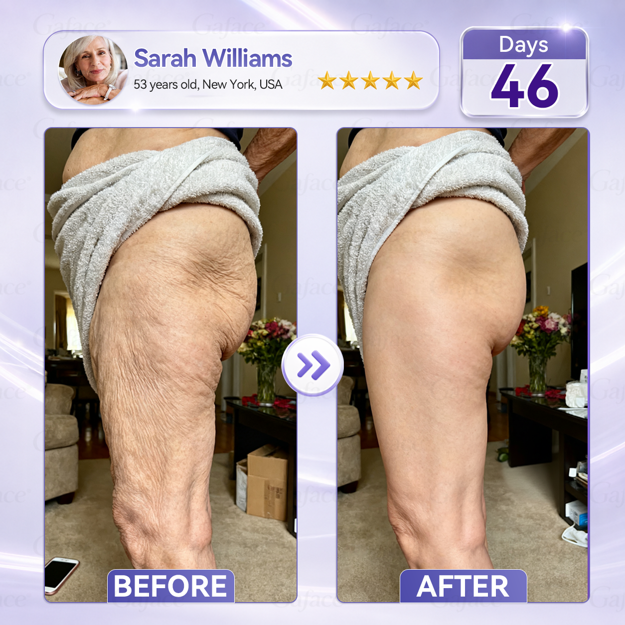 ✨👍𝐆𝐚𝐟𝐚𝐜𝐞® 𝐂𝐨𝐥𝐥𝐚𝐠𝐞𝐧 & 𝐅𝐮𝐥𝐥𝐞𝐫𝐞𝐧𝐞 𝐑𝐨𝐥𝐥𝐞𝐫 𝐅𝐢𝐫𝐦𝐢𝐧𝐠 𝐂𝐫𝐞𝐚𝐦