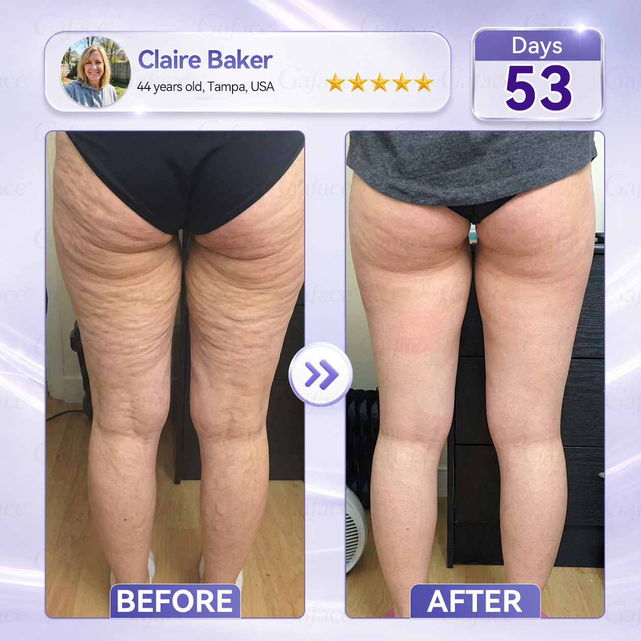 ✨👍𝐆𝐚𝐟𝐚𝐜𝐞® 𝐂𝐨𝐥𝐥𝐚𝐠𝐞𝐧 & 𝐅𝐮𝐥𝐥𝐞𝐫𝐞𝐧𝐞 𝐑𝐨𝐥𝐥𝐞𝐫 𝐅𝐢𝐫𝐦𝐢𝐧𝐠 𝐂𝐫𝐞𝐚𝐦