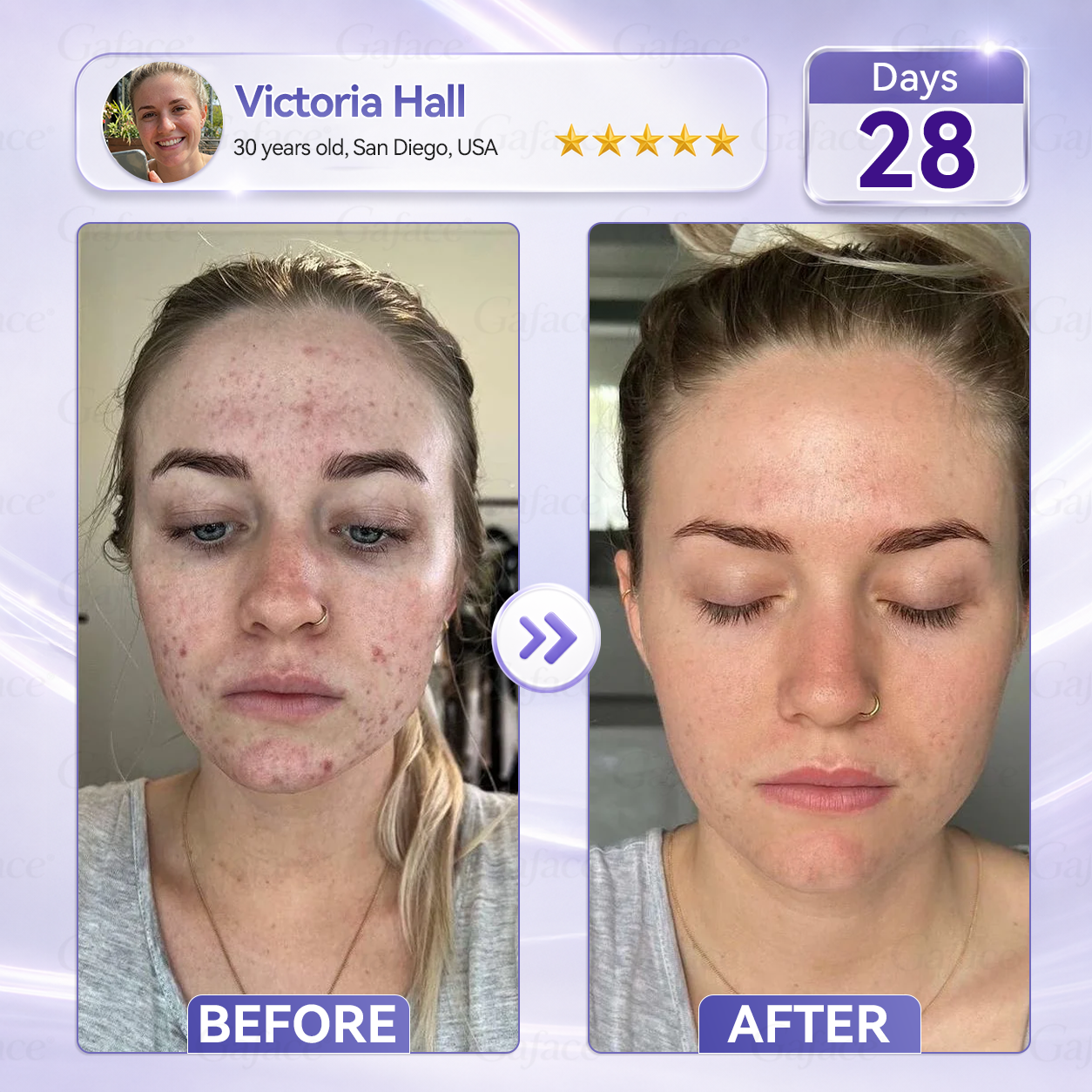 ✨👍𝐆𝐚𝐟𝐚𝐜𝐞® 𝐂𝐨𝐥𝐥𝐚𝐠𝐞𝐧 & 𝐅𝐮𝐥𝐥𝐞𝐫𝐞𝐧𝐞 𝐑𝐨𝐥𝐥𝐞𝐫 𝐅𝐢𝐫𝐦𝐢𝐧𝐠 𝐂𝐫𝐞𝐚𝐦