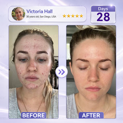 ✨👍𝐆𝐚𝐟𝐚𝐜𝐞® 𝐂𝐨𝐥𝐥𝐚𝐠𝐞𝐧 & 𝐅𝐮𝐥𝐥𝐞𝐫𝐞𝐧𝐞 𝐑𝐨𝐥𝐥𝐞𝐫 𝐅𝐢𝐫𝐦𝐢𝐧𝐠 𝐂𝐫𝐞𝐚𝐦