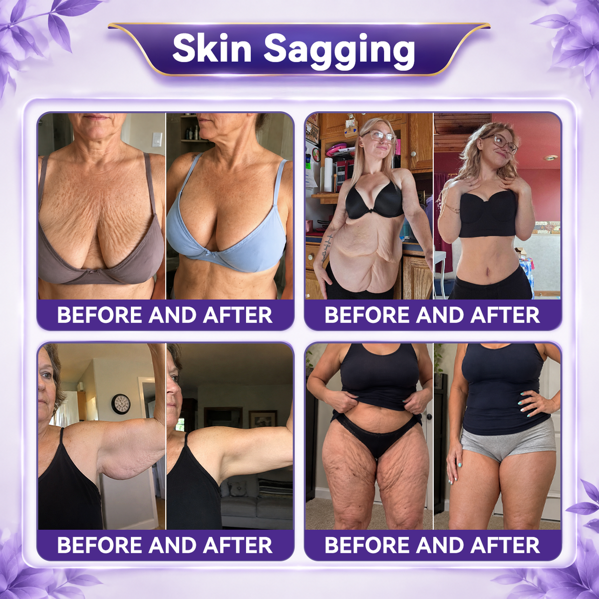✨👍𝐆𝐚𝐟𝐚𝐜𝐞® 𝐂𝐨𝐥𝐥𝐚𝐠𝐞𝐧 & 𝐅𝐮𝐥𝐥𝐞𝐫𝐞𝐧𝐞 𝐑𝐨𝐥𝐥𝐞𝐫 𝐅𝐢𝐫𝐦𝐢𝐧𝐠 𝐂𝐫𝐞𝐚𝐦