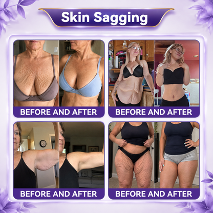 ✨👍𝐆𝐚𝐟𝐚𝐜𝐞® 𝐂𝐨𝐥𝐥𝐚𝐠𝐞𝐧 & 𝐅𝐮𝐥𝐥𝐞𝐫𝐞𝐧𝐞 𝐑𝐨𝐥𝐥𝐞𝐫 𝐅𝐢𝐫𝐦𝐢𝐧𝐠 𝐂𝐫𝐞𝐚𝐦