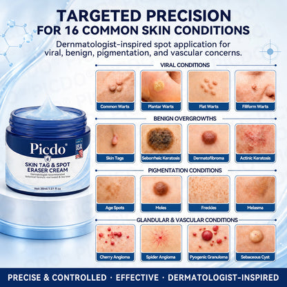 ✨👍𝐏𝐢𝐜𝐝𝐨® 7-𝐃𝐚𝐲 𝐒𝐤𝐢𝐧 𝐓𝐚𝐠 & 𝐒𝐩𝐨𝐭 𝐄𝐫𝐚𝐬𝐞𝐫 𝐂𝐫𝐞𝐚𝐦🩵 (Zero Pain, Zero 𝐒𝐜𝐚𝐫𝐬 Formula)